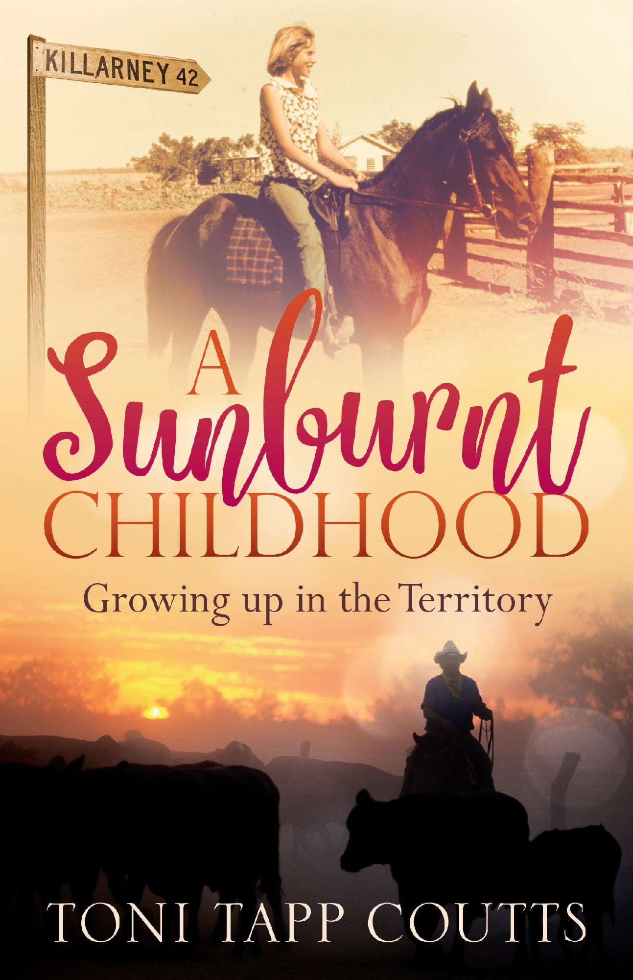 Sunburn Childhood